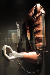 Prosthetic arm