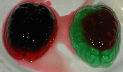 Brains